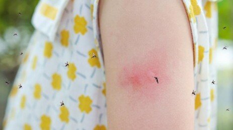 “서울 한복판에서도 걸린다”…여름철 말라리아, 독감과 뭐가 다를까