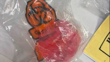 뜨거운 차 안에 둔 말랑이 장난감 폭발…13세 소녀 화상