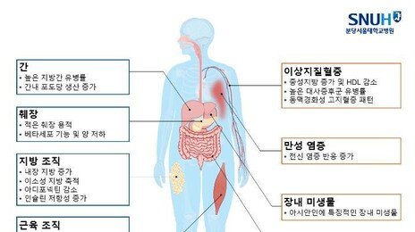 “BMI 정상인데 대사질환 위험”…한국인 32%, 체중만 봐선 놓친다