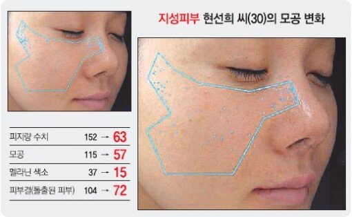 헬스&뷰티]뷰티체험 지상중계 Before&After｜동아일보