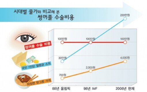 건강]20년 전 쌍꺼풀 수술 가격은 얼마?｜동아일보