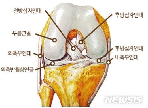 무릎에서 뚝 소리 났다면 이것 을 의심 뉴스 동아닷컴