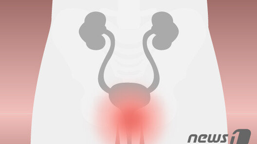 고령화와 함께 늘어나는 전립선비대증…최소침습 치료 ‘아이틴드’ 주목