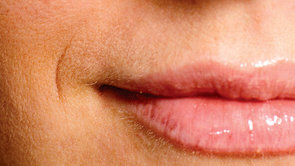 ‘노안의 척도’ 팔자주름 개선하는 필살기