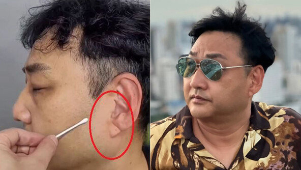 쓰러진 김수용 귓불에 깊은 사선 주름…심혈관 이상 전조?