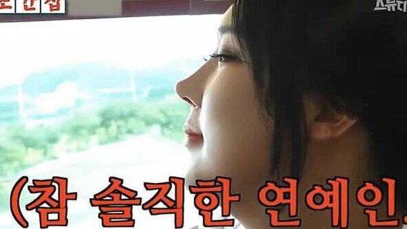 풍자 또 코 성형 “5번째 수술…이번엔 갈비뼈로”