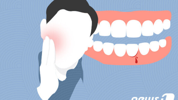 단순 잇몸 염증인 줄 알았는데…8주 지나도 안 낫는다면