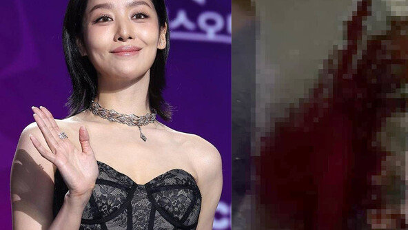 ‘활동 중단’ 차주영, 심각했던 코피 증상 “1시간 넘게…”