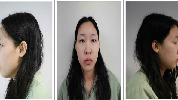 “모텔 연쇄살인 피의자는 20세 김소영” 신상공개