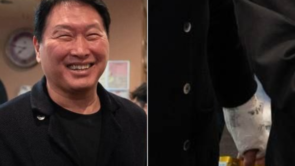 [단독]최태원 회장 손 깁스에 낙서, 누가 했을까 [재계팀의 비즈워치]