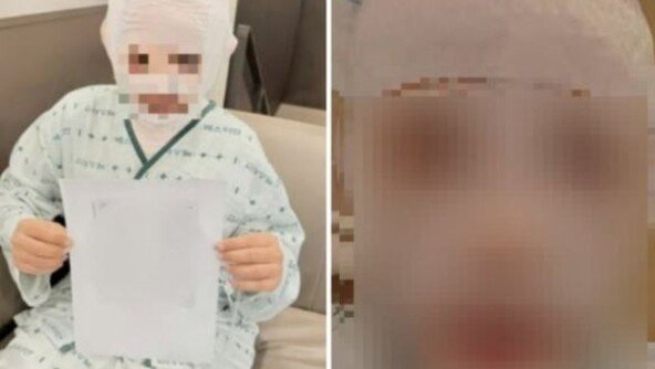 끓는 물 부은 남편 감쌌던 아내 “처벌 원해” 마음 바꿨다