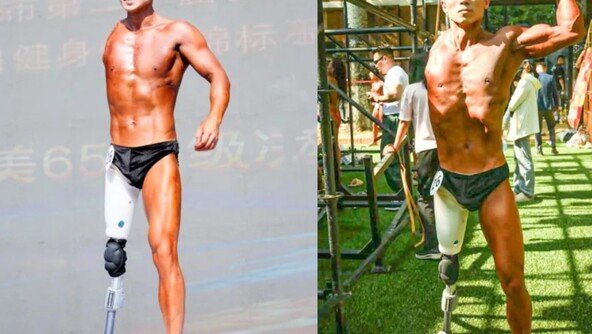 “팔·다리 잃고도 다시 운동 시작” 보디빌딩 무대 오른 30대 남성