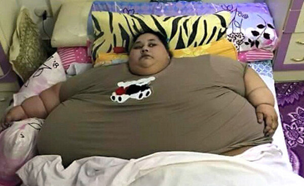 몸무게 500kg 25년간 집에만 세계에서 가장 뚱뚱한 여성 소다