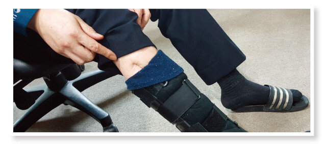 사고로 18년째 오른쪽 다리에 보조기를 착용한 김형경 경사는 “흉측하다”며 상흔의 일부만 보여줬다. [조성식 기자]