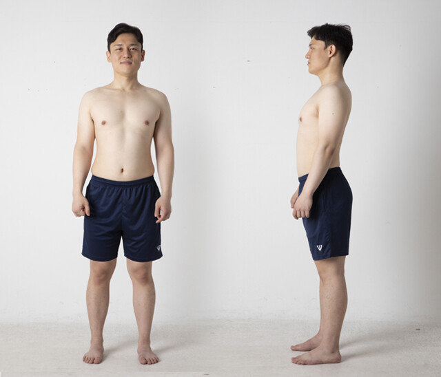 8월 18일 촬영한 이현준 기자의 몸. [박해윤 기자]
