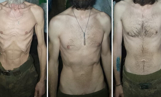 갈비뼈 앙상한 우크라 병사들…17일간 굶고 체중 40kg 줄기도