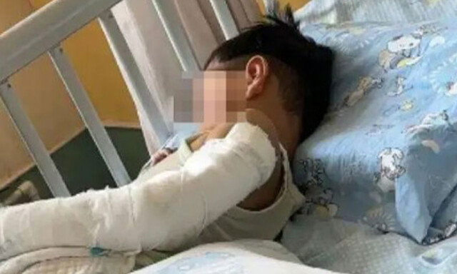 “엄마 오는지 보려” 11층서 추락한 4살 아이, 기적적 생존