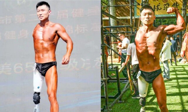 “팔·다리 잃고도 다시 운동 시작” 보디빌딩 무대 오른 30대 남성 