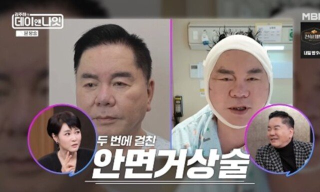 심형래 얼굴 2번이나 갈아엎어…안면거상술 심경