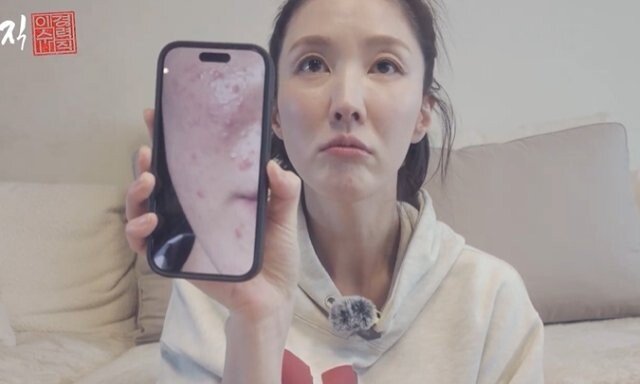 이수경 얼굴 충격 “사업 실패 후 피부병까지 얻었다”