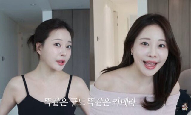 30대 아옳이, 필러 맞은 듯 불어나…뱃살 심각 문제