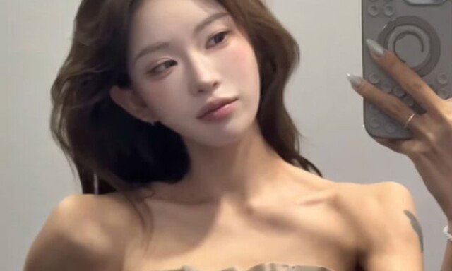 ‘최진실 딸’ 최준희, 어깨 필러+승모근 보톡스 ‘달라졌나’