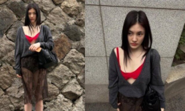 김용지, 겨우 가렸네…이러고 외출 가능?