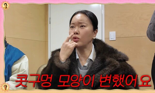 “콧구멍 변해” 백지영, 성형 10억설 고백…정석원 ‘연골 약속♥’ [DA클립]