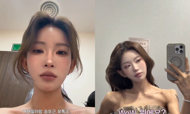 ‘최진실 딸’ 최준희, 어깨 필러+승모근 보톡스 “실시간 보정 신기해”