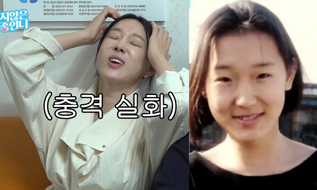 이지혜, ‘인중축소술’까지 했는데 어쩌나…“성형 전 관상이 훨씬 좋아” (관종언니)