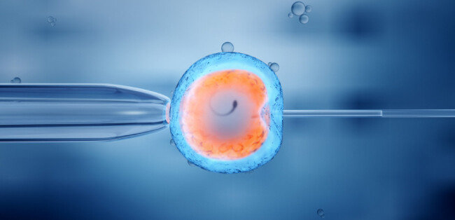 체외수정 시 주삿바늘을 이용해 정자를 난자의 세포질 내에 주입시키는 장면.