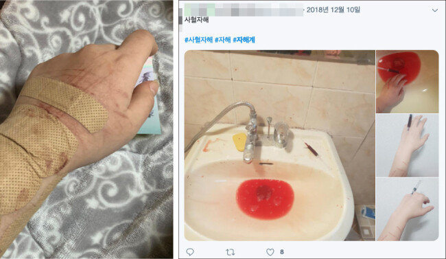 SNS에 등록돼 있는 자해 인증 콘텐츠. 