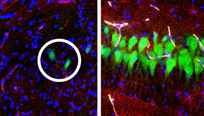 죽은 지 10시간 된 돼지 뇌를 분리해 해마 부위를 형광물질을 이용해 관찰했다. 왼쪽은 보통의 뇌, 오른쪽은 미국 예일대 연구팀이 ‘브레인엑스’ 기술로 액체를 주입해 일부 뇌세포의 기능을 회복시킨 사진. 신경세포(원 안) 등의 분포 차이가 확연하다. [예일대 의대 제공]