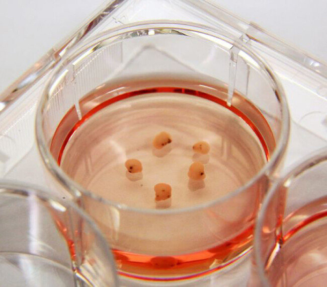 실험실에서 줄기세포를 배양하면 지름 수mm의 미니 뇌인 ‘뇌 오가노이드’를 만들 수 있다. 미니 뇌가 의식을 가질 경우에 대비하려면 사전에 윤리적 논의가 이뤄져 있어야 한다. [싱가포르게놈연구소 제공]