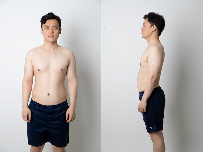 8월 3일 촬영한 이현준 기자의 몸. [지호영 기자]