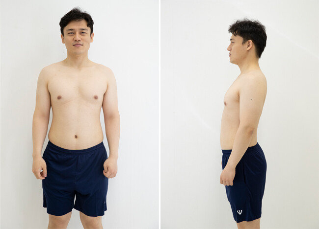 8월 11일 촬영한 이현준 기자의 몸. [지호영 기자]