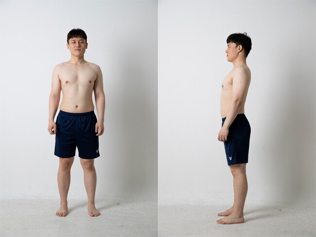 8월 26일 촬영한 이현준 기자의 몸. [지호영 기자]