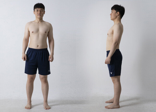 8월 31일 촬영한 이현준 기자의 몸. [박해윤 기자]