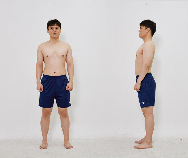 9월 7일 촬영한 이현준 기자의 몸. [홍중식 기자]