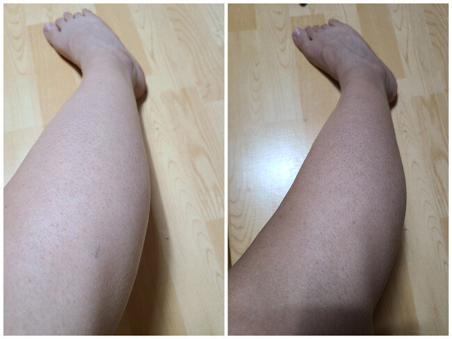 태닝 하기 전(좌) 5회 태닝 한 후(우)의 다리 비교. 육안으로 봐도 피부가 탔다.