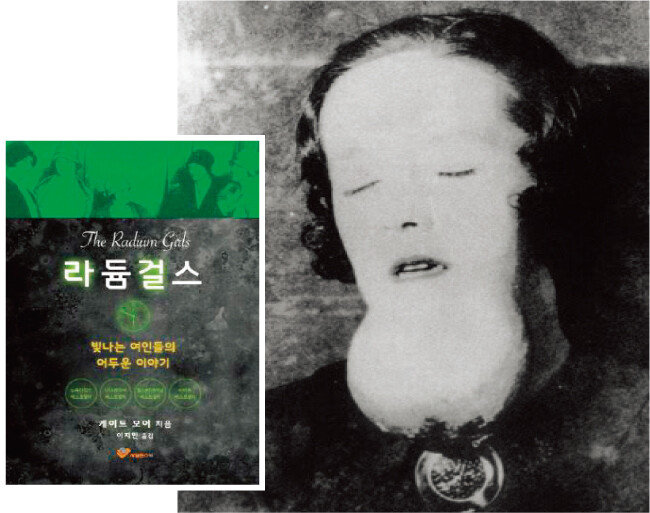 턱 아래 커다란 육종이 생긴 라듐 걸(왼쪽)과 ‘라듐 걸스’ 표지. [사진 제공  ·  사일런스북]