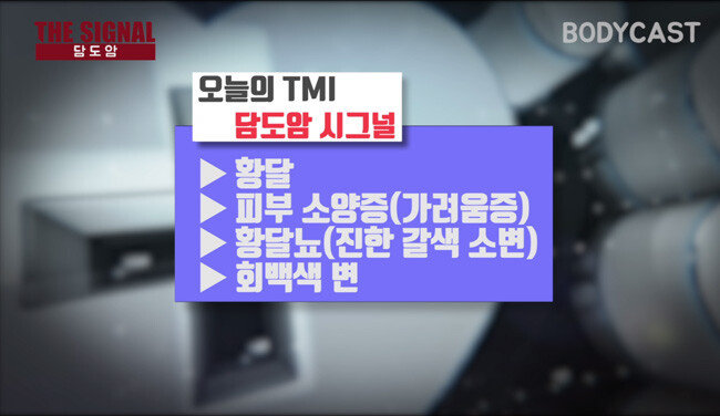 담도암 시그널.