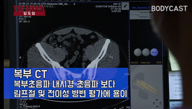 복부 CT는 전이성 병변 진단에 용이하다.