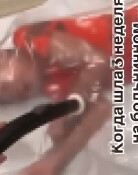 “엄마!” 비명에도 아들 진공포장…‘좋아요’에 눈먼 러시아 엄마