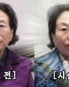 “곱게 나이 들고 싶다” 전원주, 500만원 들여 피부 시술 받아