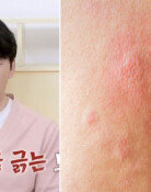 김승수 “뾰루지인 줄 알았는데…사망 직전까지 갔다” 무슨일?