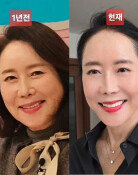 64세 윤영미 확 바뀐 외모…“용기 내길 잘했다 생각” [노화설계]
