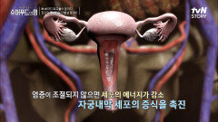 염증 못 잡으면 자궁내막암 ↑ 한국인이 유독 염증에 취약한 이유 | tvN STORY 221002 방송