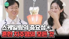 [닥터하우스] 치아 상실의 주범, 치주염 흔한 치태와 치주가 원인이 된다?! #치주염