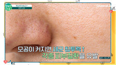 [닥터하우스] 모공 좀 커진다고 피부건강에 문제 있을까?